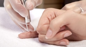 Odstranite neželjene bradavice na rukama, nogama, licu ili vratu LASEROM, BIOLASEROM ili OZONOM u Beauty Centru Kozlinger Zagreb uz nevjerojatnih 82% POPUSTA!