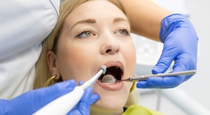 Profesionalno IZBJELJIVANJE zubi u Dental Župan – uz KOMPLETAN tretman čišćenja kamenca, pjeskarenja i poliranja za blistav i zdrav osmijeh! ZASJAJTE savršenim osmijehom – rezervirajte svoj termin!