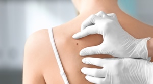 Uklonite madeže, bradavice ili lipome SIGURNO i BEZBOLNO. Vrhunska dermatoskopija i LOKALNA ANESTEZIJA u Poliklinici Superiora ZAGREB osiguravaju BRZ zahvat i estetski NAJBOLJI REZULTAT!