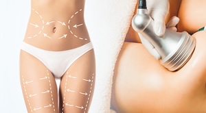 SPLIT: Otopite MASNOĆE i učvrstite kožu u Skin Glow Beauty Salonu! Odaberite M, L ili XL paket MRŠAVLJENJA: kavitacija, limfna drenaža, radiofrekvencija i vakum za NIKAD BRŽE rezultate!