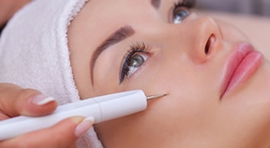 Uklonite neželjene KAPILARE s lica u Beauty Centru Kozlinger u Zagrebu - BEZBOLNO RJEŠENJE estetskog problema vidljivih kapilara uz STRUČNJAKE!