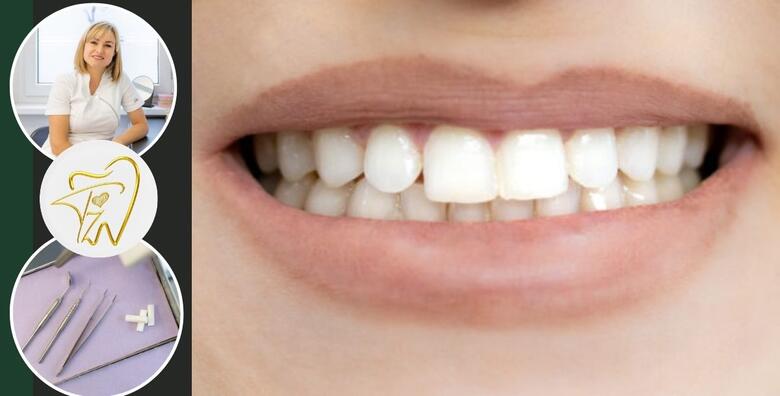 Čišćenje kamenca, pjeskarenje i fluoridacija zubi u Ordinaciji dentalne medicine Tijana Župan,dr.med.dent.