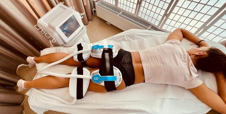 Oblikujte i zategnite tijelo uz Tesla tretmane + RF tehnologiju u Alma beauty centru