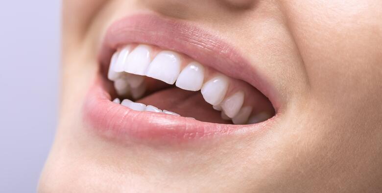 Dental studio Marić - Čišćenje zubnog kamenca, pjeskarenje i pregled