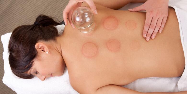 5 cupping tretmana (30–60 min) u Aura Beauty Studiju