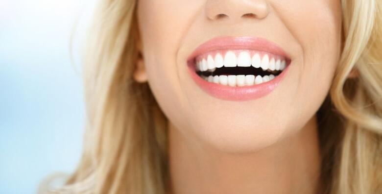 Lasersko čišćenje zubnih džepova i uklanjanje zubnog kamenca i naslaga u Dental centru Habeković